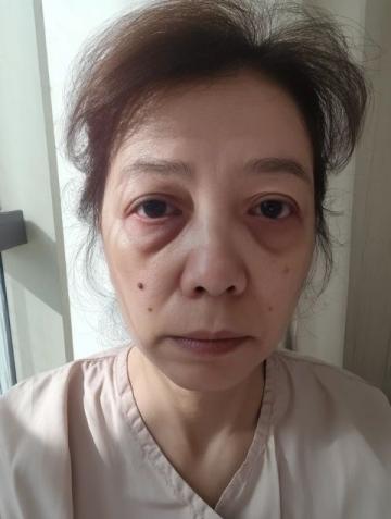 玉醬回國前，硬拉著山口去醫院做了一次全面體檢，回到山東老家，山口打視頻電話