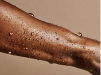 白癜風日常防護指南：飲食與生活習慣建議