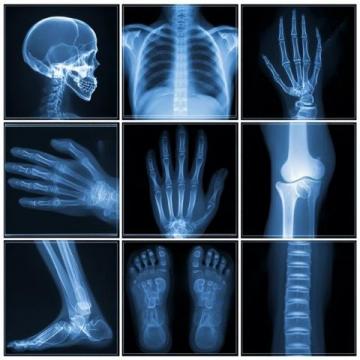 放射醫(yī)學(xué)技術(shù)考試口訣大全:高效記憶關(guān)鍵知識(shí)點(diǎn)