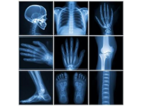 放射醫(yī)學(xué)技術(shù)考試口訣大全：高效記憶關(guān)鍵知識(shí)點(diǎn)