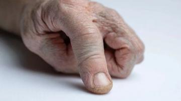 揭秘哺乳動(dòng)物五指之謎:遺傳密碼與自然選擇的力量